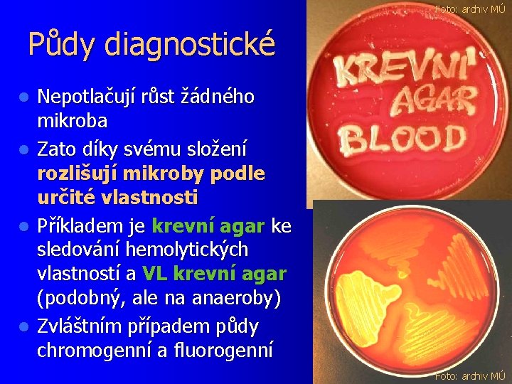 Foto: archiv MÚ Půdy diagnostické l l Nepotlačují růst žádného mikroba Zato díky svému