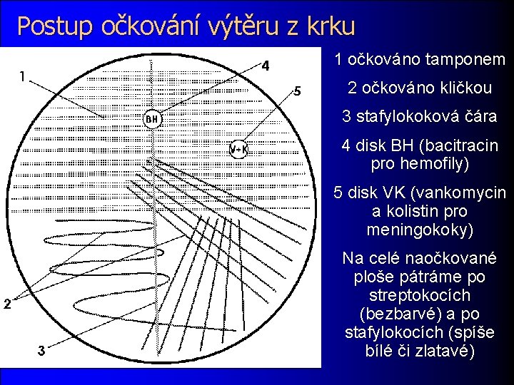 Postup očkování výtěru z krku 1 očkováno tamponem 2 očkováno kličkou 3 stafylokoková čára