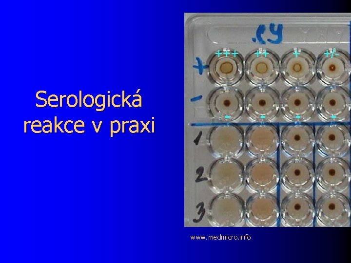 Serologická reakce v praxi +++ ++ + +/- - - www. medmicro. info 