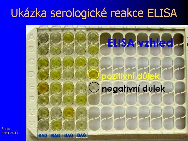 Ukázka serologické reakce ELISA Foto: archiv MÚ 