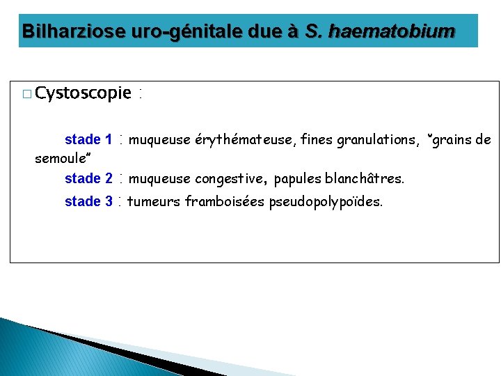 Bilharziose uro-génitale due à S. haematobium � Cystoscopie stade 1 semoule’’ stade 2 :