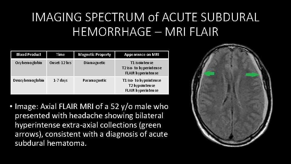 IMAGING SPECTRUM of ACUTE SUBDURAL HEMORRHAGE – MRI FLAIR Blood Product Time Magnetic Property