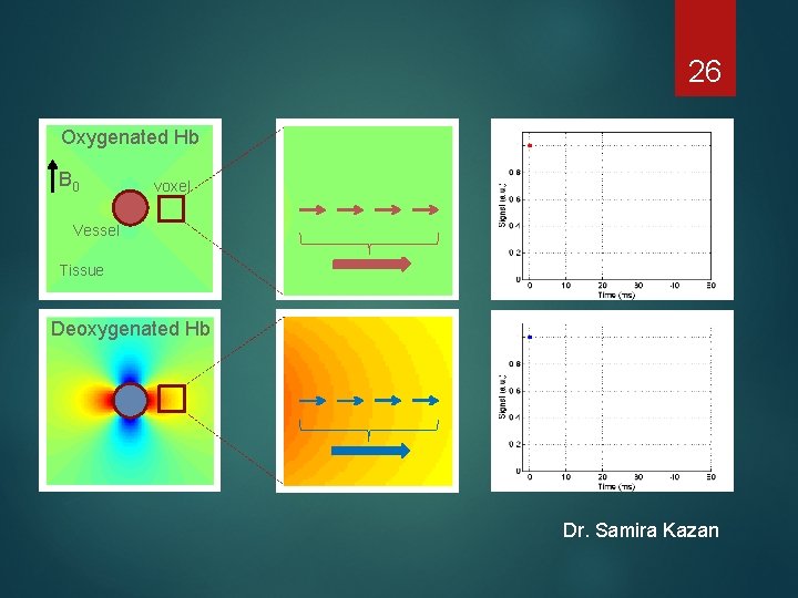 26 Oxygenated Hb B 0 voxel Vessel Tissue Deoxygenated Hb 26 Dr. Samira Kazan