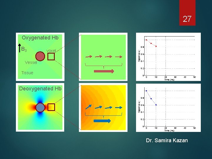 27 Oxygenated Hb B 0 voxel Vessel Tissue Deoxygenated Hb 27 Dr. Samira Kazan