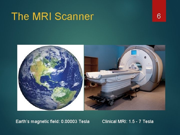 The MRI Scanner Earth’s magnetic field: 0. 00003 Tesla 6 Clinical MRI: 1. 5