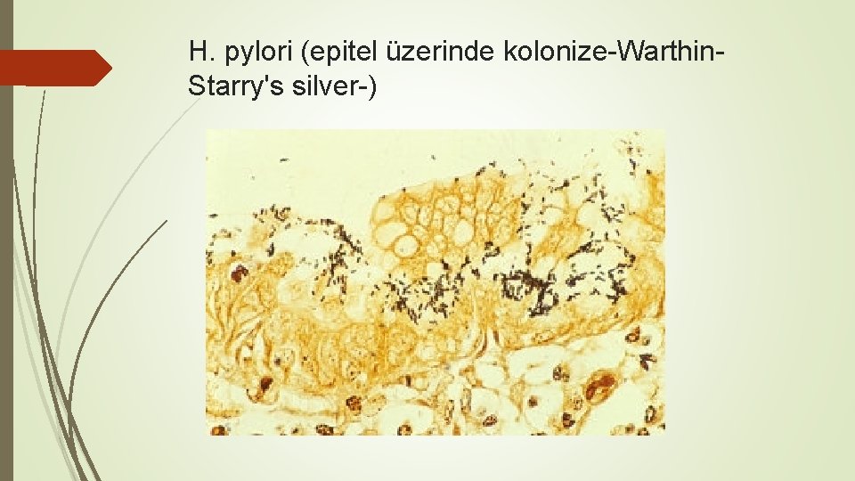 H. pylori (epitel üzerinde kolonize-Warthin. Starry's silver-) 