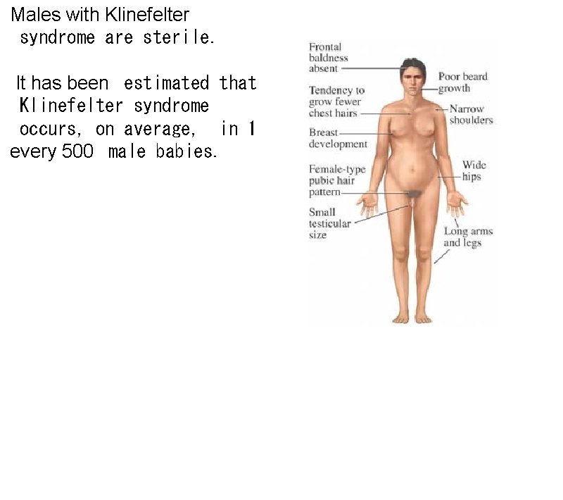 Males with Klinefelter syndrome are sterile. It has been estimated that Klinefelter syndrome occurs,