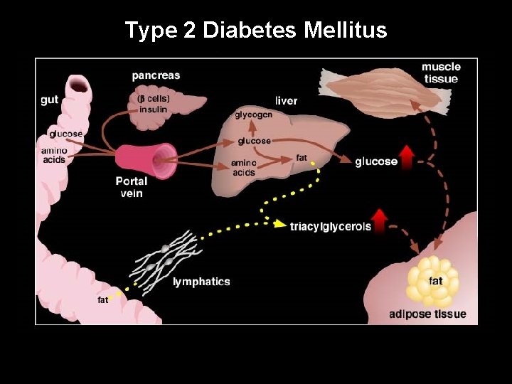 Type 2 Diabetes Mellitus UW-Madison Yandell © 2004 5 