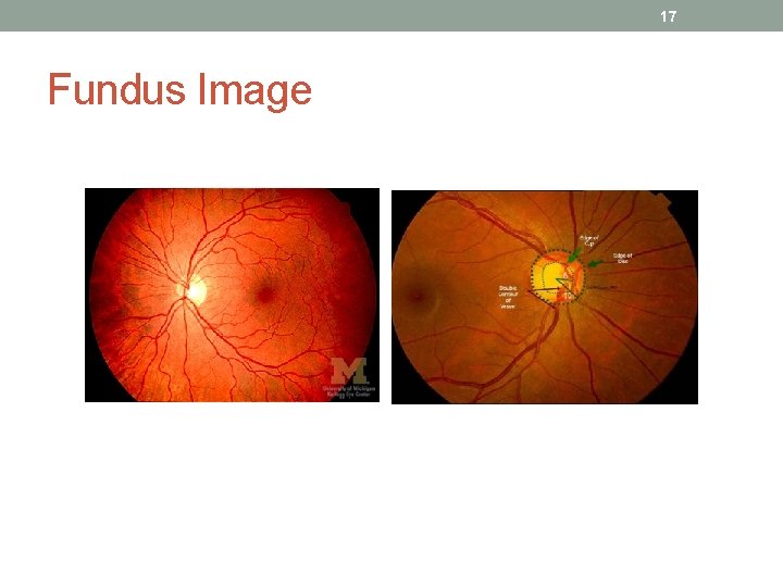 17 Fundus Image 