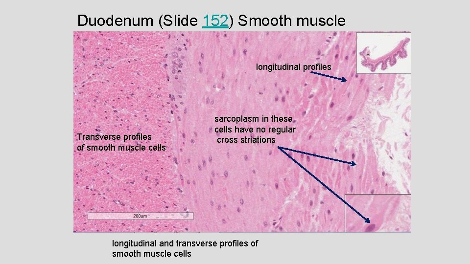 Duodenum (Slide 152) Smooth muscle longitudinal profiles Transverse profiles of smooth muscle cells sarcoplasm Duodenum (Slide 152) Smooth muscle longitudinal profiles Transverse profiles of smooth muscle cells sarcoplasm