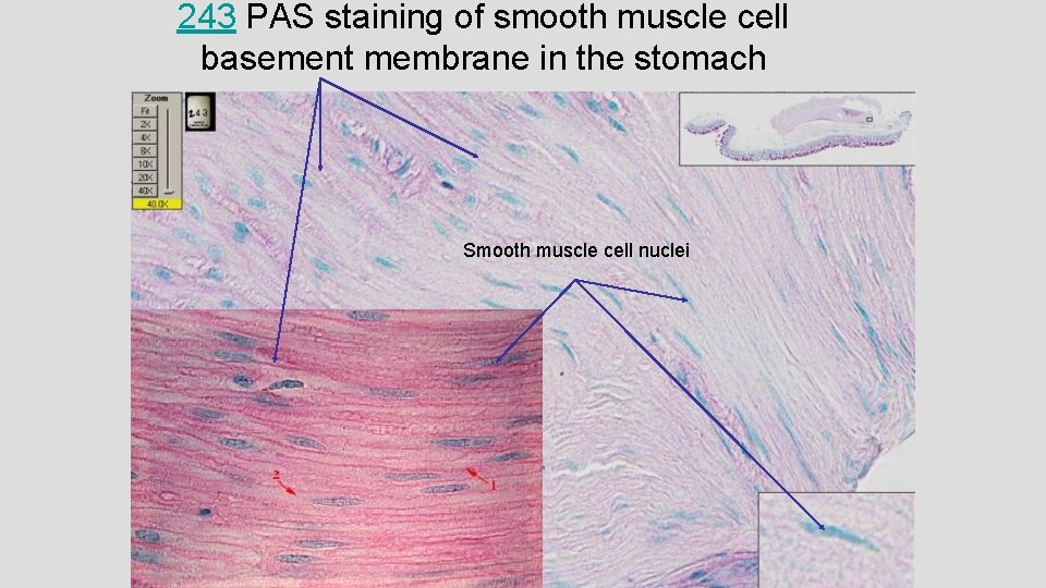 243 PAS staining of smooth muscle cell basement membrane in the stomach Smooth muscle 243 PAS staining of smooth muscle cell basement membrane in the stomach Smooth muscle