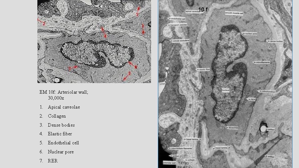 10 f EM 10 f: Arteriolar wall; 30, 000 x 1. Apical caveolae 2. 10 f EM 10 f: Arteriolar wall; 30, 000 x 1. Apical caveolae 2.