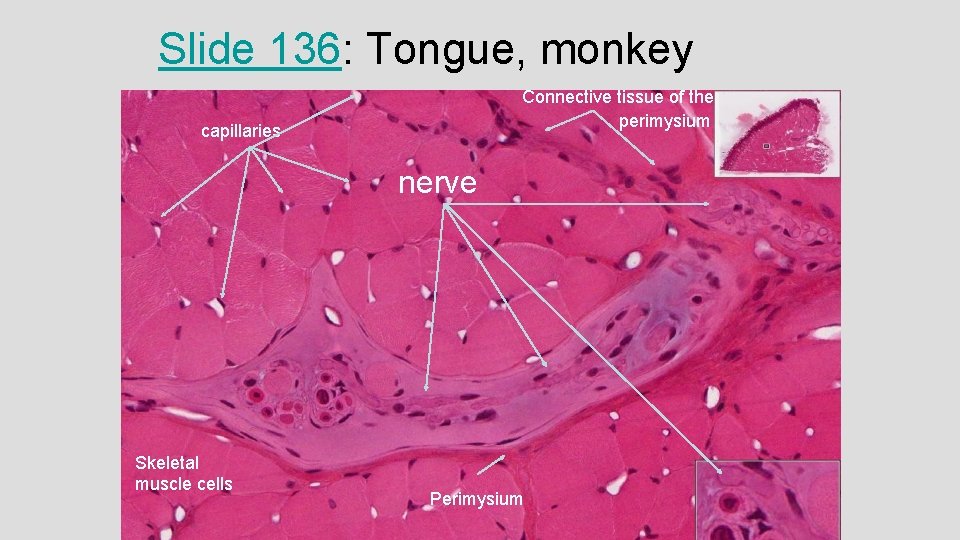 Slide 136: Tongue, monkey Connective tissue of the perimysium capillaries nerve Skeletal muscle cells Slide 136: Tongue, monkey Connective tissue of the perimysium capillaries nerve Skeletal muscle cells