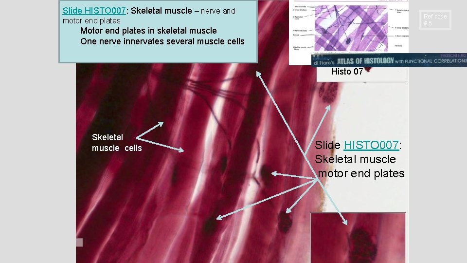 Slide HISTO 007: Skeletal muscle – nerve and Ref code #5 motor end plates Slide HISTO 007: Skeletal muscle – nerve and Ref code #5 motor end plates