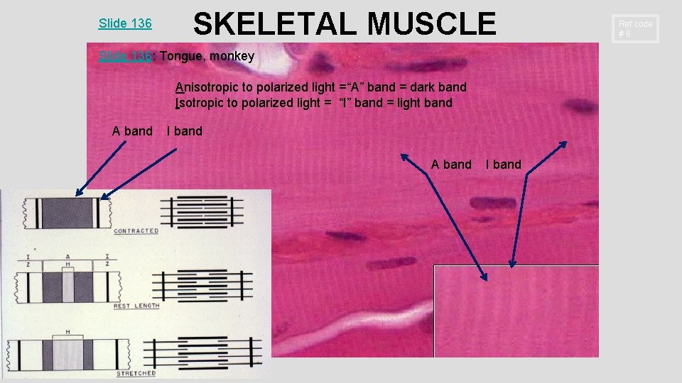 Slide 136 SKELETAL MUSCLE Slide 136: Tongue, monkey Anisotropic to polarized light =“A” band Slide 136 SKELETAL MUSCLE Slide 136: Tongue, monkey Anisotropic to polarized light =“A” band