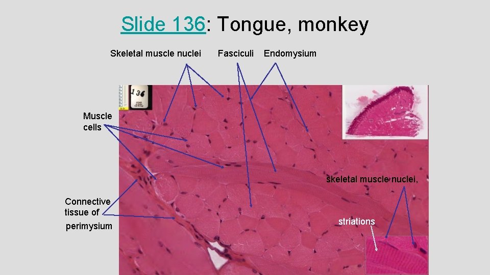 Slide 136: Tongue, monkey Skeletal muscle nuclei Fasciculi Endomysium Muscle cells skeletal muscle nuclei, Slide 136: Tongue, monkey Skeletal muscle nuclei Fasciculi Endomysium Muscle cells skeletal muscle nuclei,