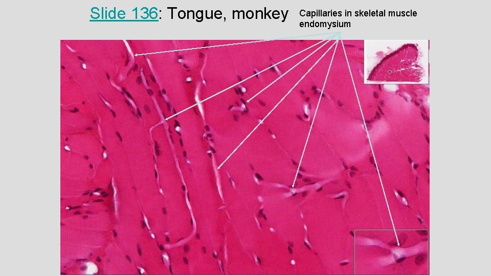 Slide 136: Tongue, monkey Capillaries in skeletal muscle endomysium Slide 136: Tongue, monkey Capillaries in skeletal muscle endomysium