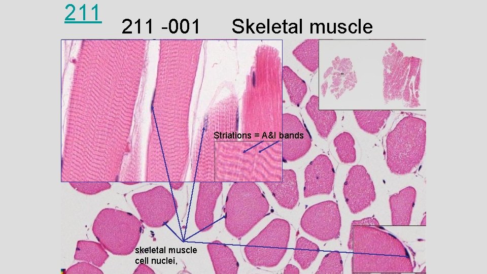211 -001 Skeletal muscle Striations = A&I bands skeletal muscle cell nuclei, 211 -001 Skeletal muscle Striations = A&I bands skeletal muscle cell nuclei,