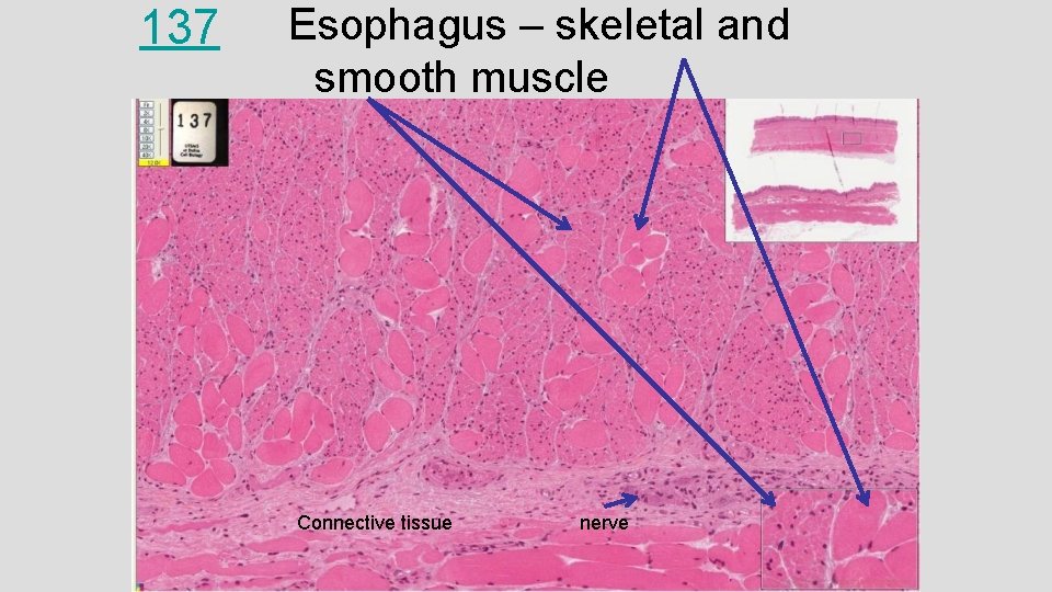 137 Esophagus – skeletal and smooth muscle Connective tissue nerve 137 Esophagus – skeletal and smooth muscle Connective tissue nerve