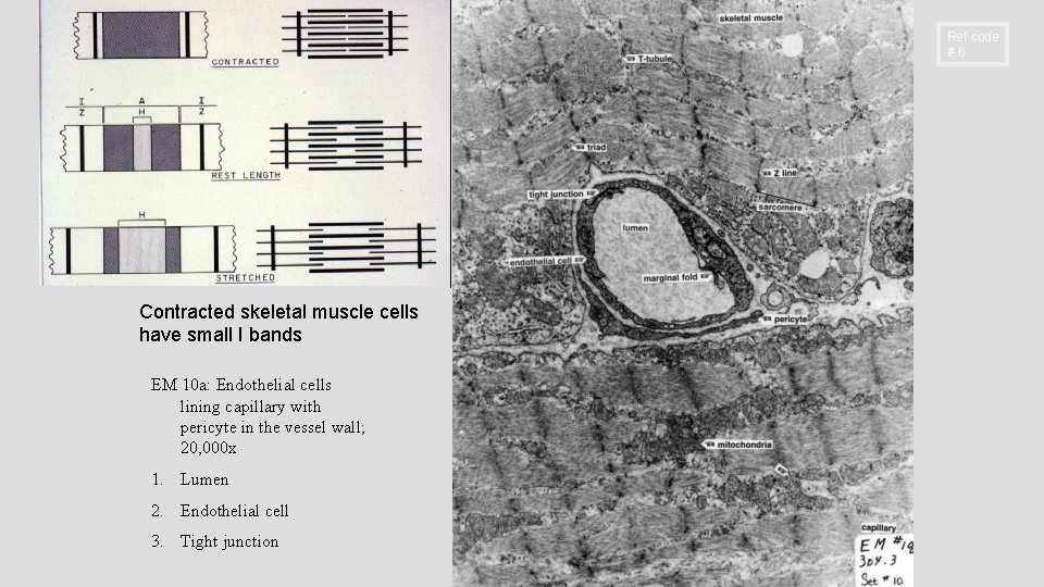 Ref code #6 Contracted skeletal muscle cells have small I bands EM 10 a: Ref code #6 Contracted skeletal muscle cells have small I bands EM 10 a: