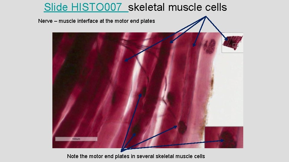 Slide HISTO 007 skeletal muscle cells Nerve – muscle interface at the motor end Slide HISTO 007 skeletal muscle cells Nerve – muscle interface at the motor end