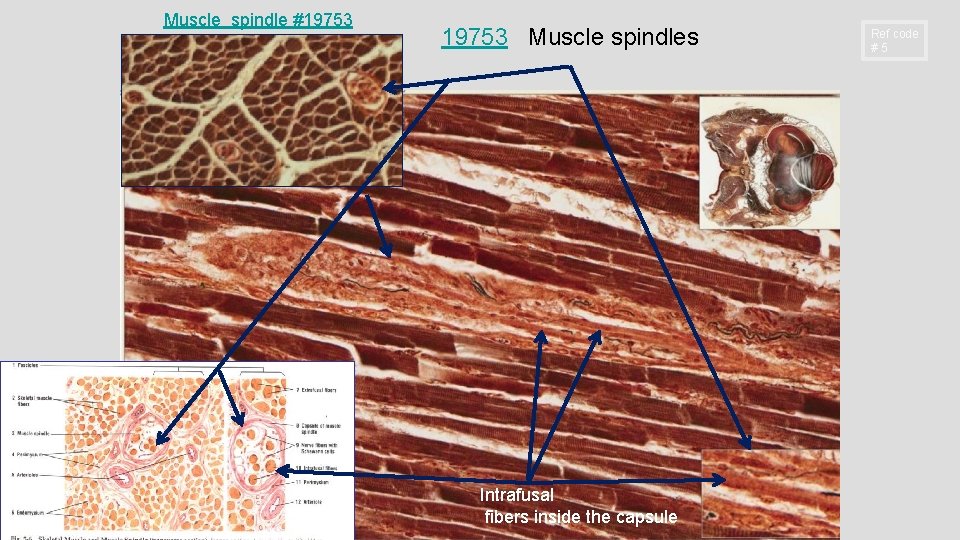 Muscle spindle #19753 Muscle spindles Intrafusal fibers inside the capsule Ref code #5 Muscle spindle #19753 Muscle spindles Intrafusal fibers inside the capsule Ref code #5