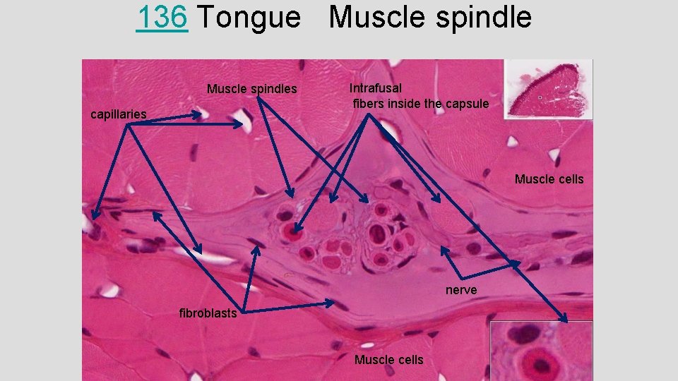 136 Tongue Muscle spindles capillaries Intrafusal fibers inside the capsule Muscle cells nerve fibroblasts 136 Tongue Muscle spindles capillaries Intrafusal fibers inside the capsule Muscle cells nerve fibroblasts