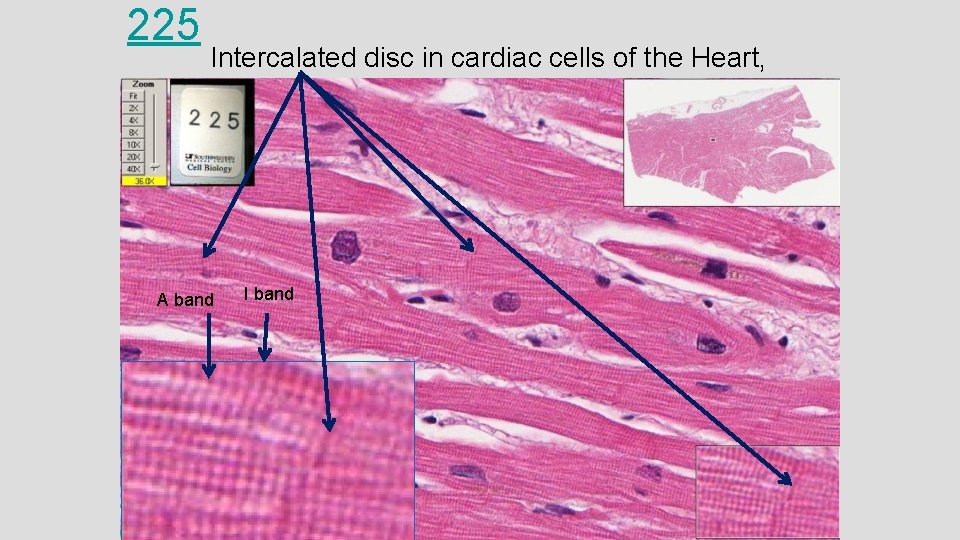 225 Intercalated disc in cardiac cells of the Heart, epicardium A band I band 225 Intercalated disc in cardiac cells of the Heart, epicardium A band I band