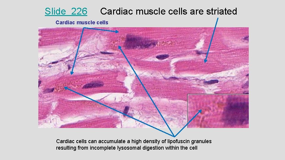 Slide 226 Cardiac muscle cells are striated Cardiac muscle cells Cardiac cells can accumulate Slide 226 Cardiac muscle cells are striated Cardiac muscle cells Cardiac cells can accumulate