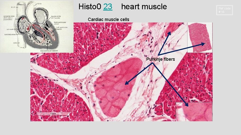 Histo 0 23 heart muscle Cardiac muscle cells Purkinje fibers Ref code # 16 Histo 0 23 heart muscle Cardiac muscle cells Purkinje fibers Ref code # 16