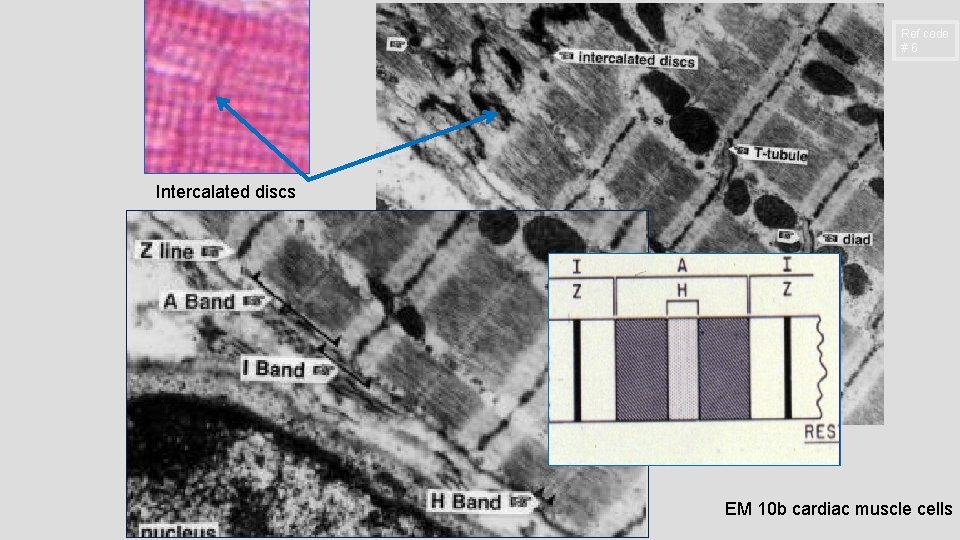 Ref code #6 Intercalated discs EM 10 b cardiac muscle cells Ref code #6 Intercalated discs EM 10 b cardiac muscle cells