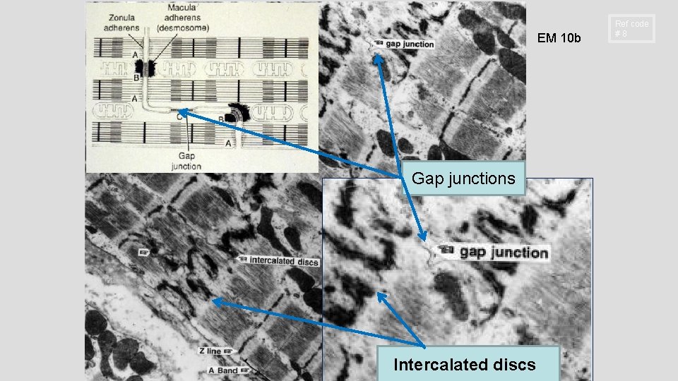 EM 10 b Gap junctions Intercalated discs Ref code #8 EM 10 b Gap junctions Intercalated discs Ref code #8