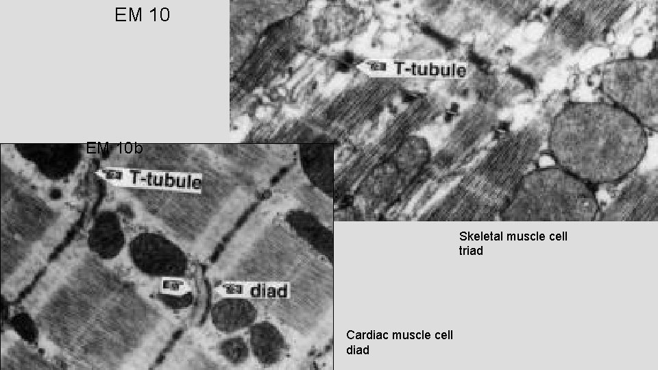 EM 10 b Skeletal muscle cell triad Cardiac muscle cell diad EM 10 b Skeletal muscle cell triad Cardiac muscle cell diad