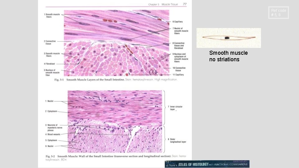 Ref code # 5, 8 Smooth muscle no striations Ref code # 5, 8 Smooth muscle no striations