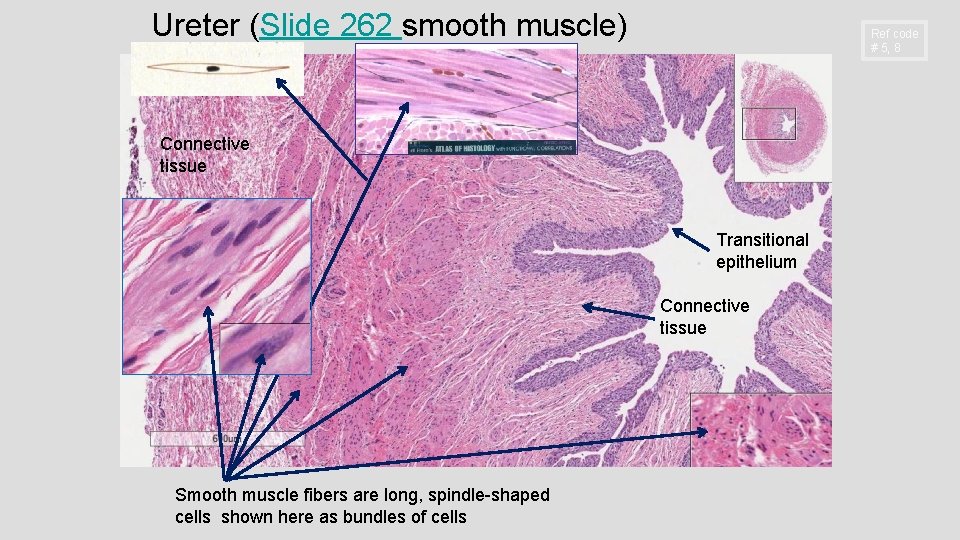 Ureter (Slide 262 smooth muscle) Ref code # 5, 8 Connective tissue Transitional epithelium Ureter (Slide 262 smooth muscle) Ref code # 5, 8 Connective tissue Transitional epithelium
