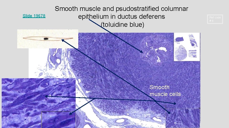 Slide 19678 Smooth muscle and psudostratified columnar epithelium in ductus deferens (toluidine blue) Smooth Slide 19678 Smooth muscle and psudostratified columnar epithelium in ductus deferens (toluidine blue) Smooth