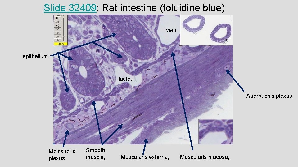 Slide 32409: Rat intestine (toluidine blue) vein epithelium lacteal Auerbach’s plexus Meissner’s plexus Smooth Slide 32409: Rat intestine (toluidine blue) vein epithelium lacteal Auerbach’s plexus Meissner’s plexus Smooth