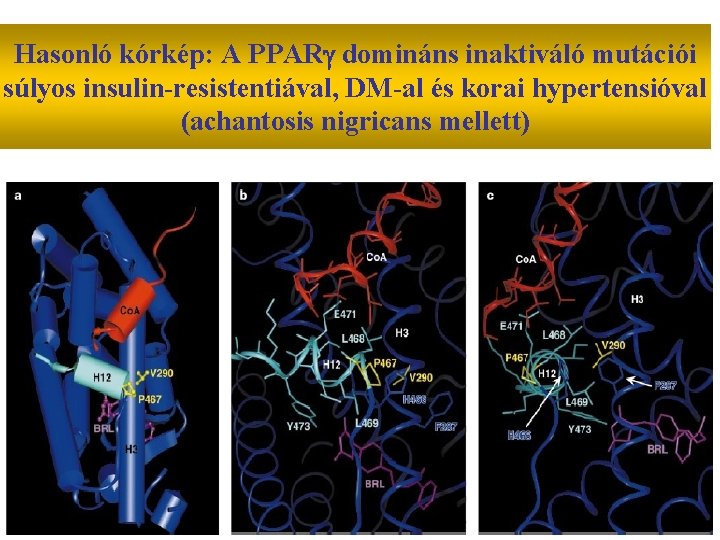 Hasonló kórkép: A PPAR domináns inaktiváló mutációi súlyos insulin-resistentiával, DM-al és korai hypertensióval (achantosis