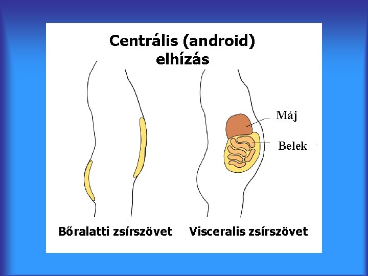 Centrális (android) elhízás Máj Belek Bőralatti zsírszövet Visceralis zsírszövet 