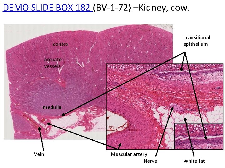 DEMO SLIDE BOX 182 (BV-1 -72) –Kidney, cow. Transitional epithelium contex medulla Vein Muscular