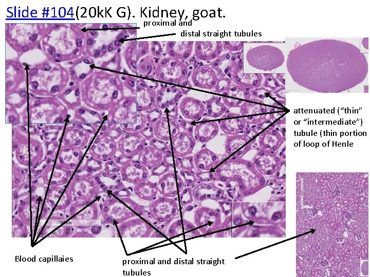 Slide #104(20 k. K G). Kidney, goat. proximal and distal straight tubules attenuated (“thin”