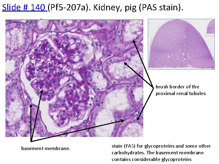 Slide # 140 (Pf 5 -207 a). Kidney, pig (PAS stain). brush border of