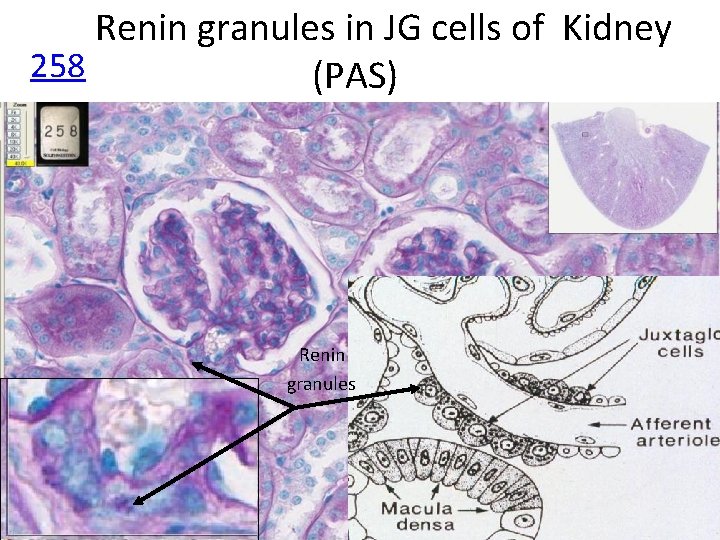 Renin granules in JG cells of Kidney 258 (PAS) Renin granules 