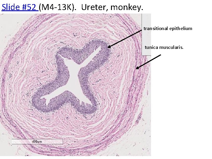 Slide #52 (M 4 -13 K). Ureter, monkey. transitional epithelium tunica muscularis. 
