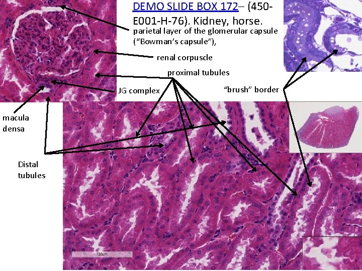DEMO SLIDE BOX 172– (450 E 001 -H-76). Kidney, horse. parietal layer of the