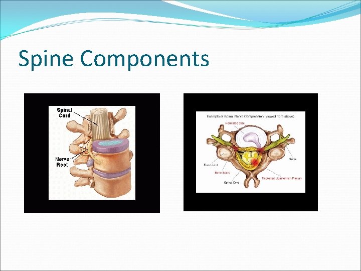 Spine Components 