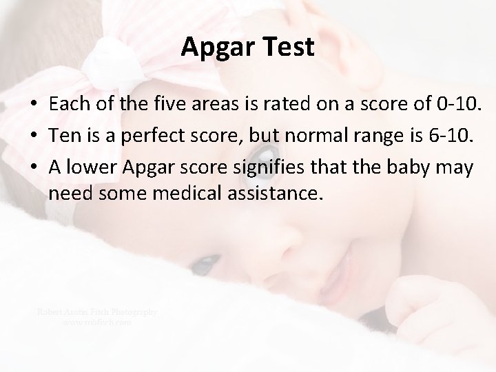 Apgar Test • Each of the five areas is rated on a score of