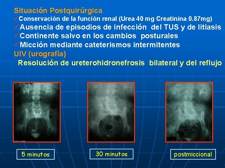 Situación Postquirúrgica üConservación de la función renal (Urea 40 mg Creatinina 0. 87 mg)