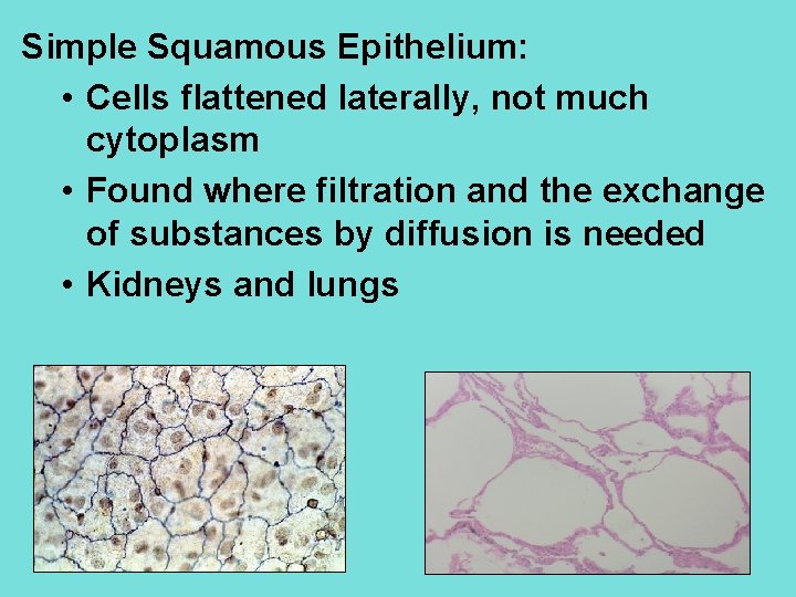 Simple Squamous Epithelium: • Cells flattened laterally, not much cytoplasm • Found where filtration