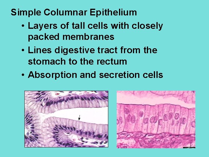 Simple Columnar Epithelium • Layers of tall cells with closely packed membranes • Lines